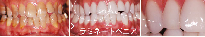 画像の説明